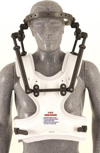 Back Brace Wisconsin Spinal Orthosis Walkabout